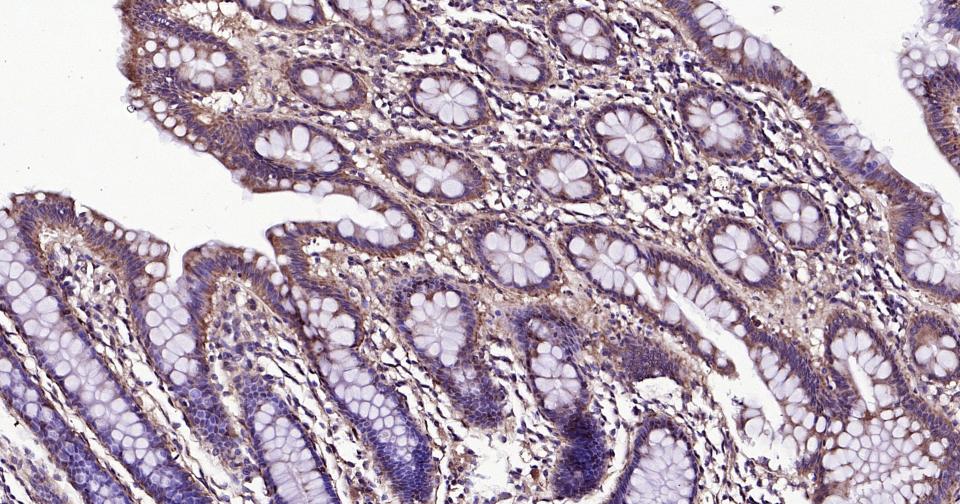 自噬效应蛋白Beclin 1重组兔单抗