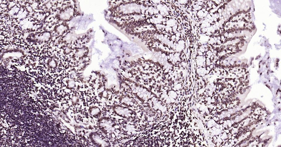 核纤层蛋白B重组兔单抗