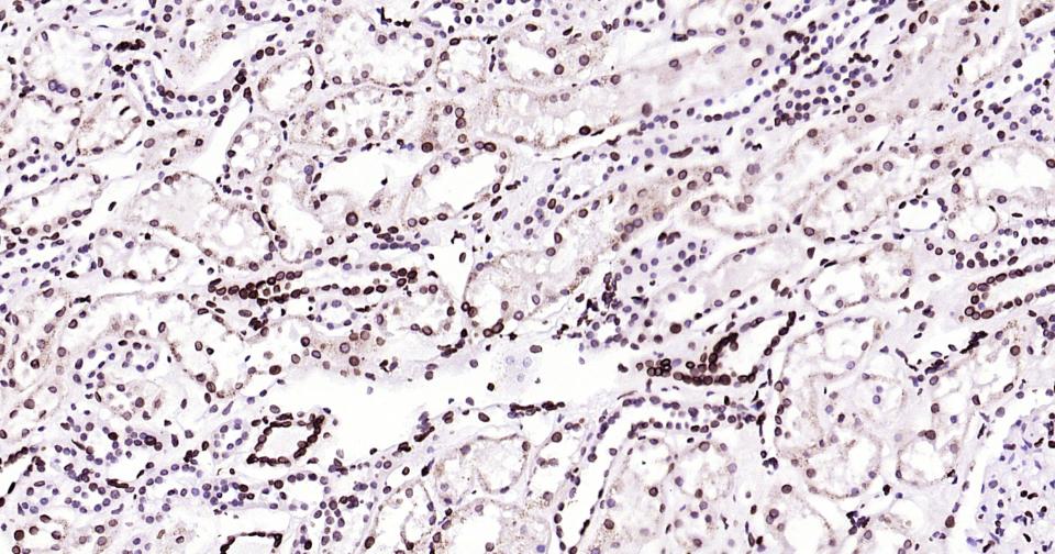 核纤层蛋白B重组兔单抗