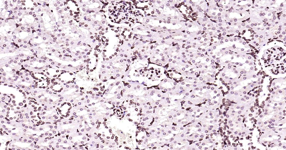 核纤层蛋白B重组兔单抗