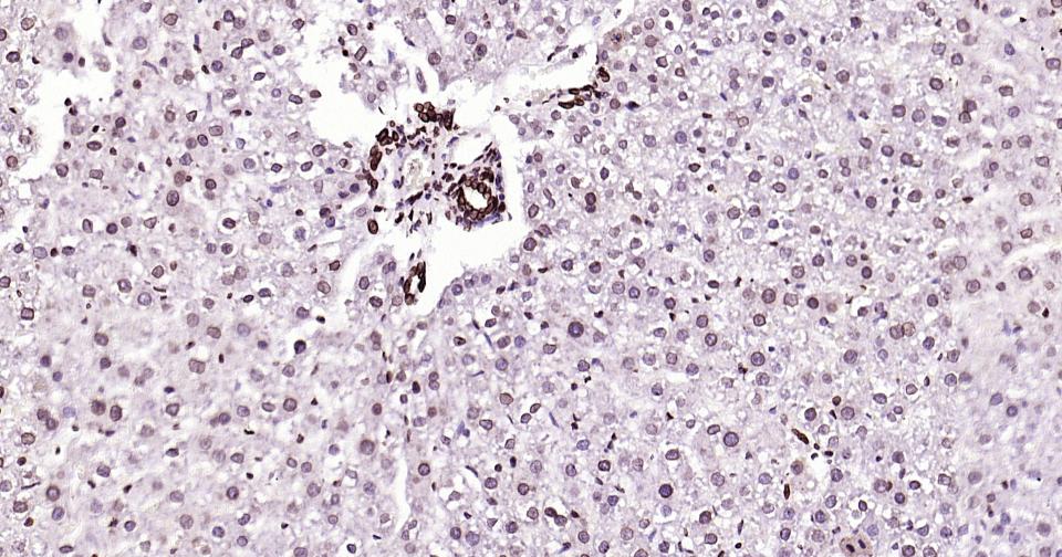 核纤层蛋白B重组兔单抗