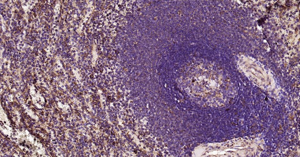 细胞凋亡诱导蛋白NALP3抗体-bs-10021R