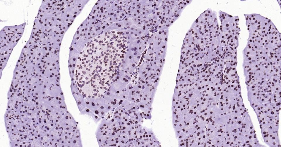 核纤层蛋白B重组兔单抗