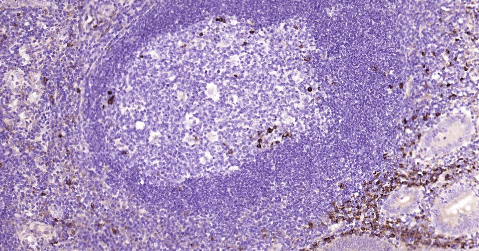 细胞凋亡诱导蛋白NALP3抗体-bs-10021R