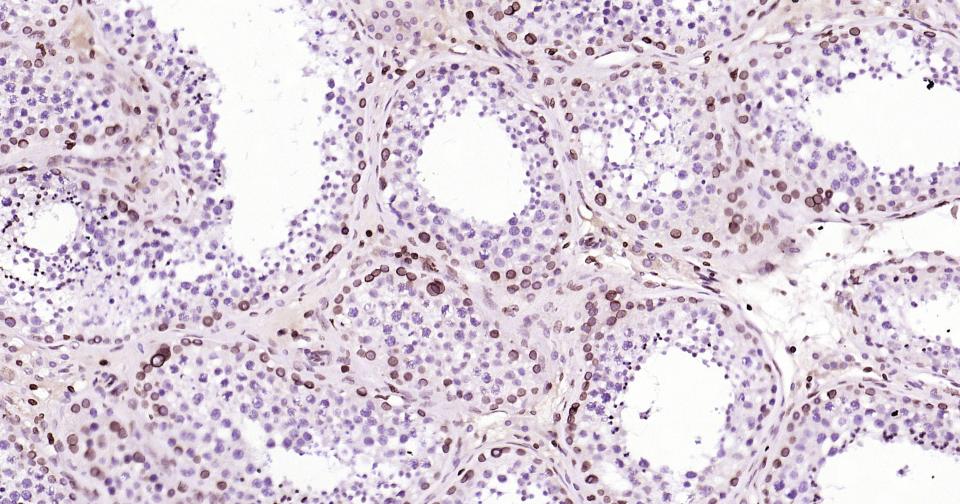 核纤层蛋白B重组兔单抗