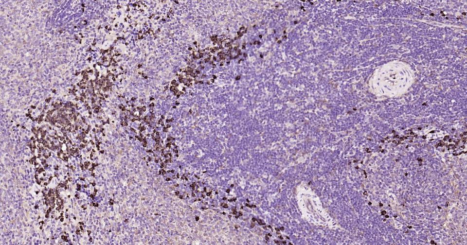 细胞凋亡诱导蛋白NALP3抗体-bs-10021R