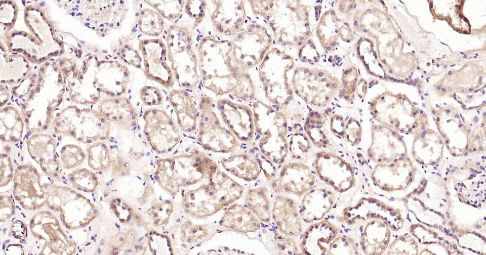 自噬效应蛋白Beclin 1重组兔单抗