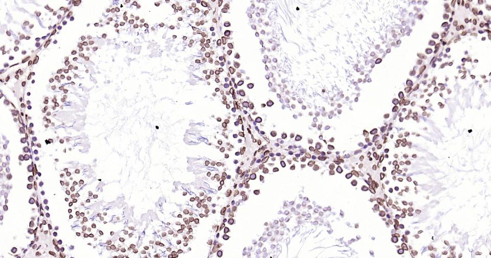 核纤层蛋白B重组兔单抗