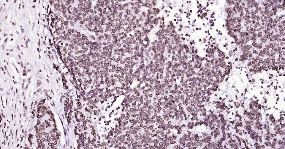 核纤层蛋白B重组兔单抗