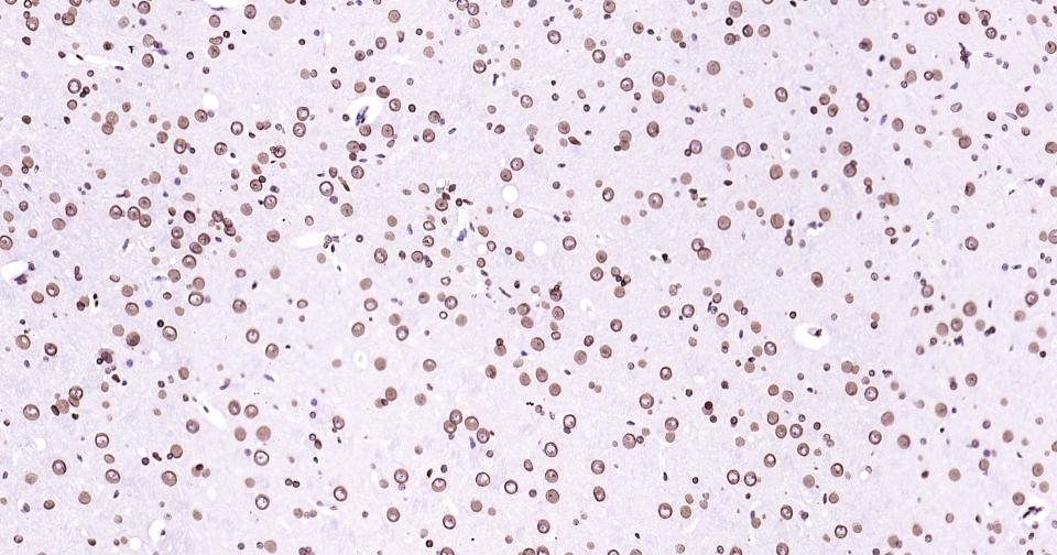 核纤层蛋白B重组兔单抗