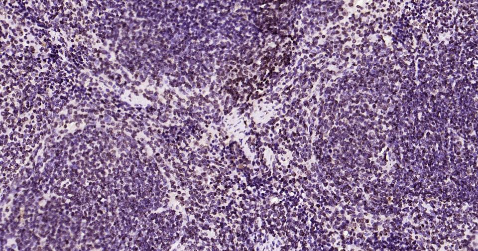 核纤层蛋白B重组兔单抗