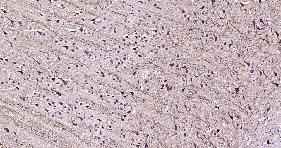 磷酸化微管相关蛋白2重组兔单抗-bsm-62863R