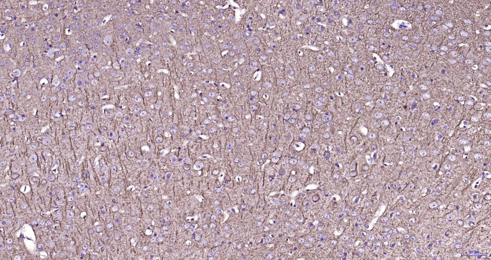 磷酸化微管相关蛋白2重组兔单抗-bsm-62863R