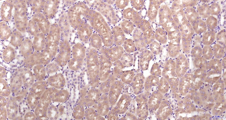 KB抑制蛋白激酶α重组兔单抗