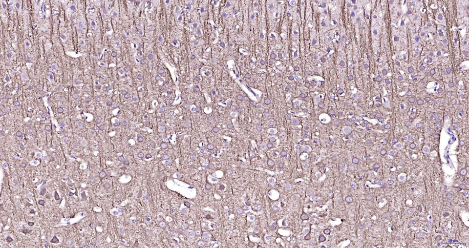 phospho-MAP2 (Ser136) Recombinant Rabbit mAb (一抗) - IHC-P,IHC-F,IF,ICC/IF | Bioss