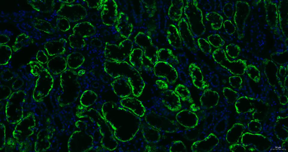 凋亡诱导因子重组兔单抗