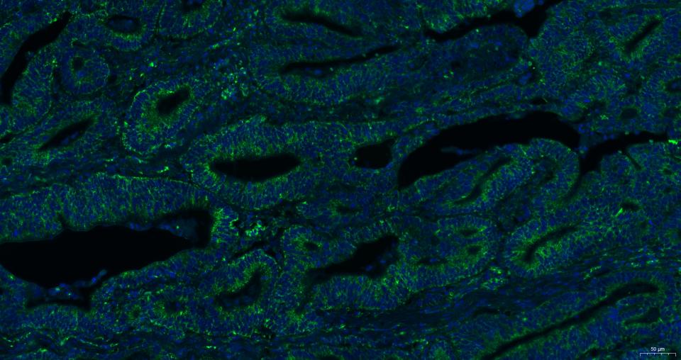 凋亡诱导因子重组兔单抗