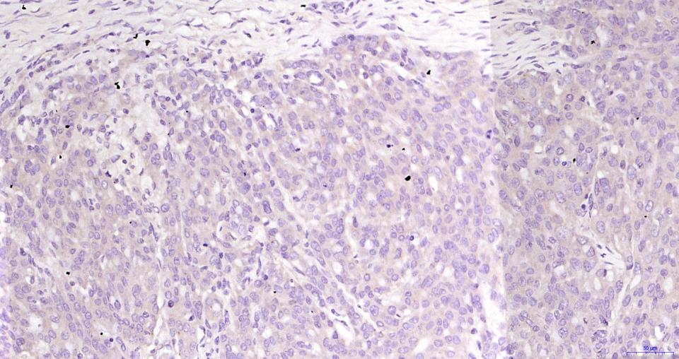 KB抑制蛋白激酶α重组兔单抗