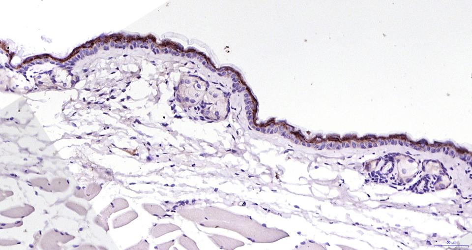 KB抑制蛋白激酶α重组兔单抗