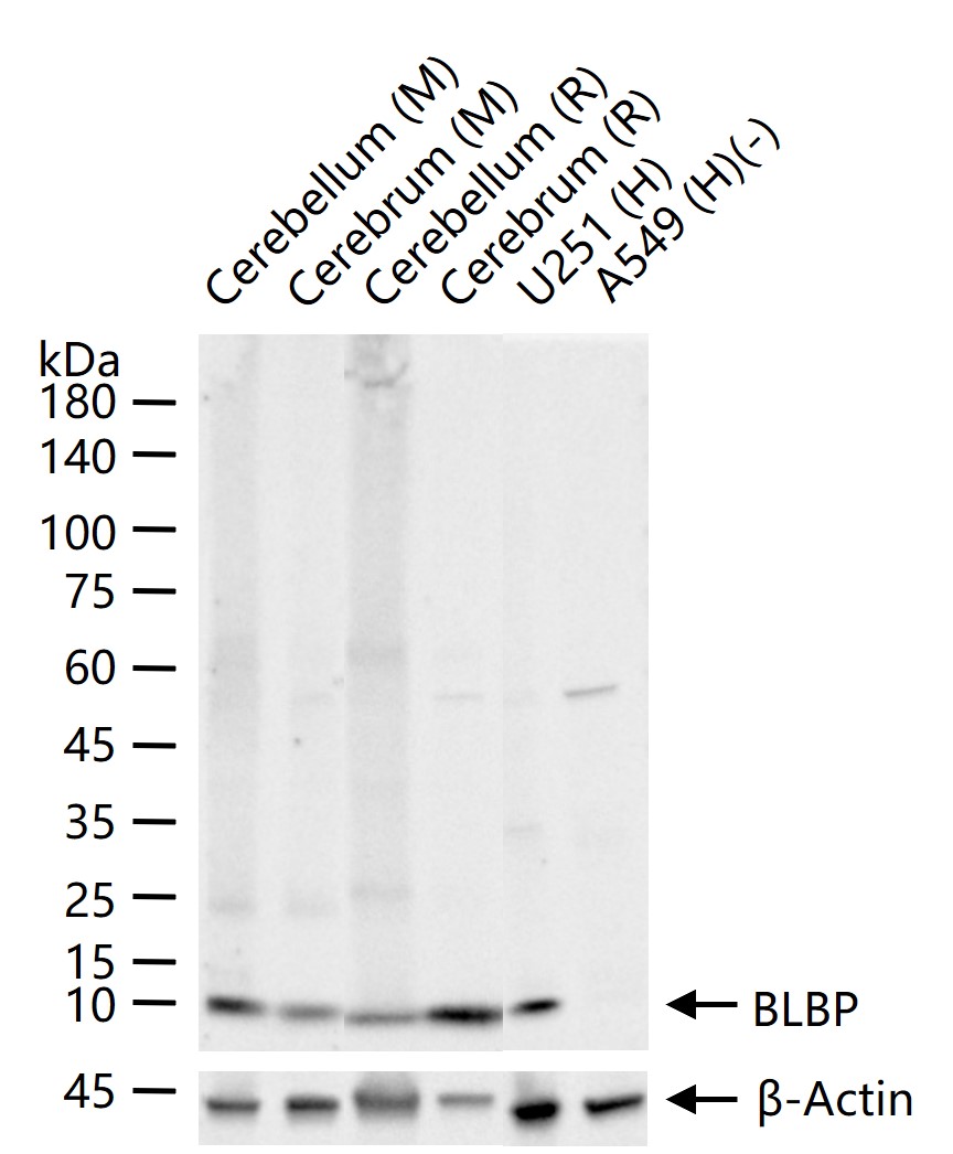 BLBP Recombinant Mouse mAb (一抗) - WB,IHC-P,IHC-F,IF | Bioss