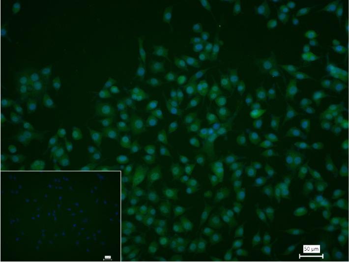 胰岛素基因增强结合蛋白1重组兔单抗