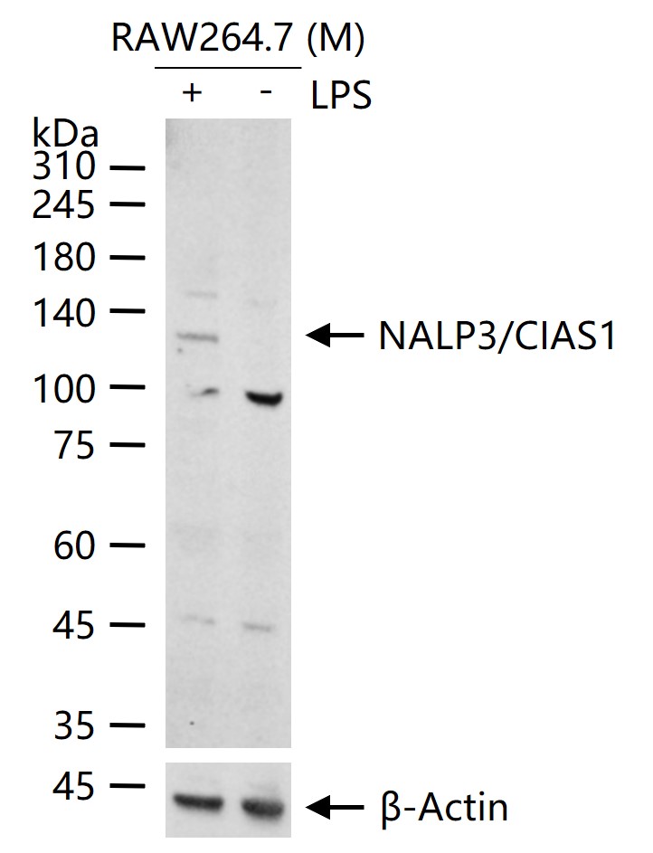 NALP3/CIAS1 Rabbit pAb (一抗) | Bioss