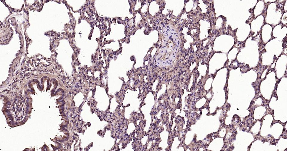 RAS相关蛋白Rab5B抗体-bs-11783R