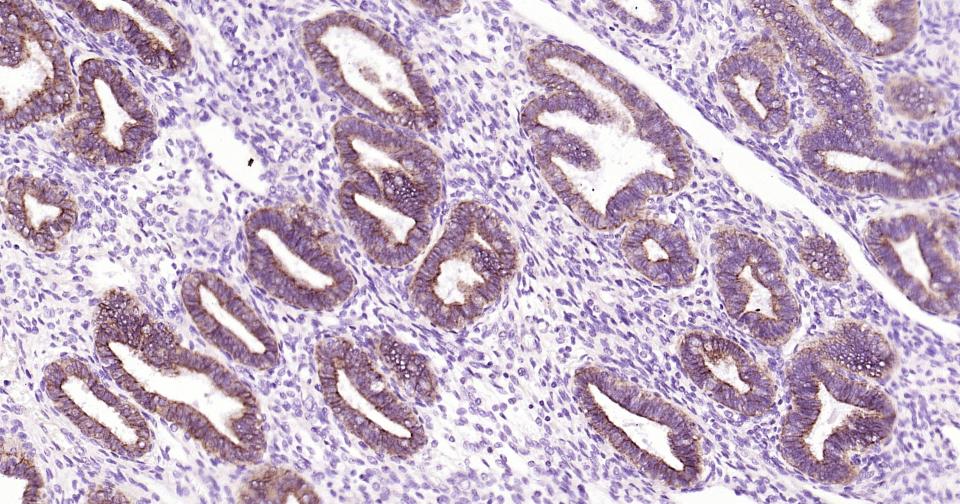 细胞色素cP450 CYP26A1重组兔单抗
