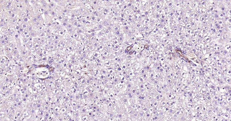 细胞色素cP450 CYP26A1重组兔单抗