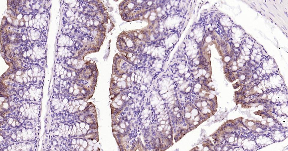 细胞色素cP450 CYP26A1重组兔单抗