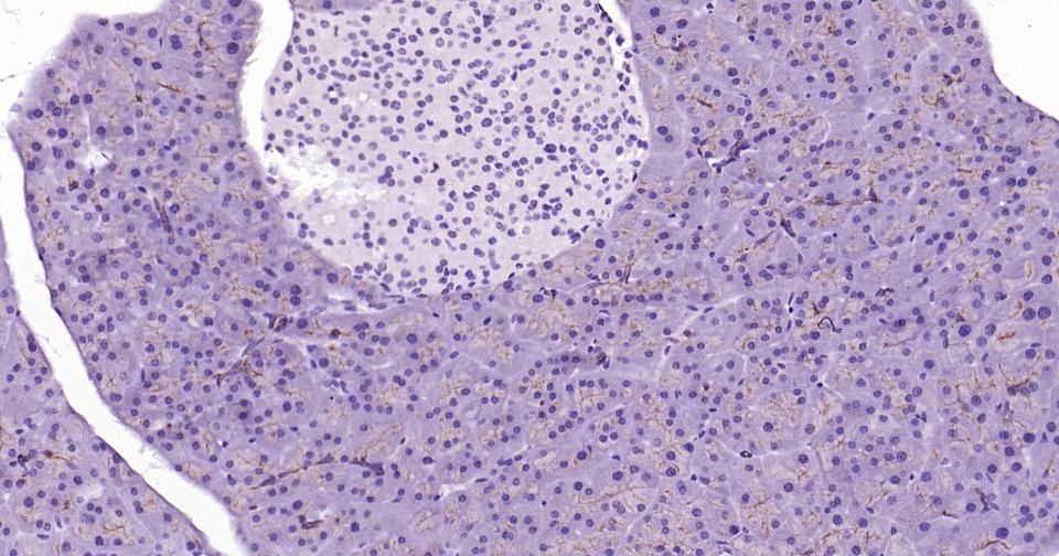 细胞色素cP450 CYP26A1重组兔单抗