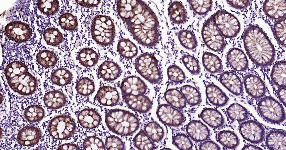 细胞色素cP450 CYP26A1重组兔单抗