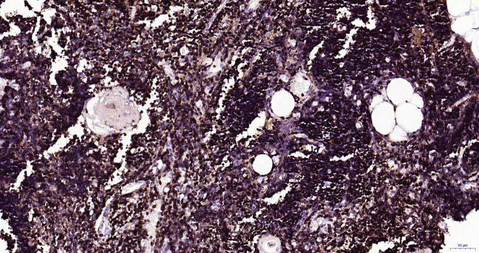 白细胞共同抗原CD45抗体-bs-0522R