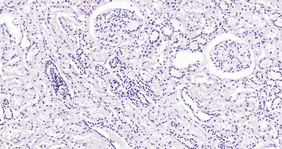 白细胞共同抗原CD45抗体-bs-0522R