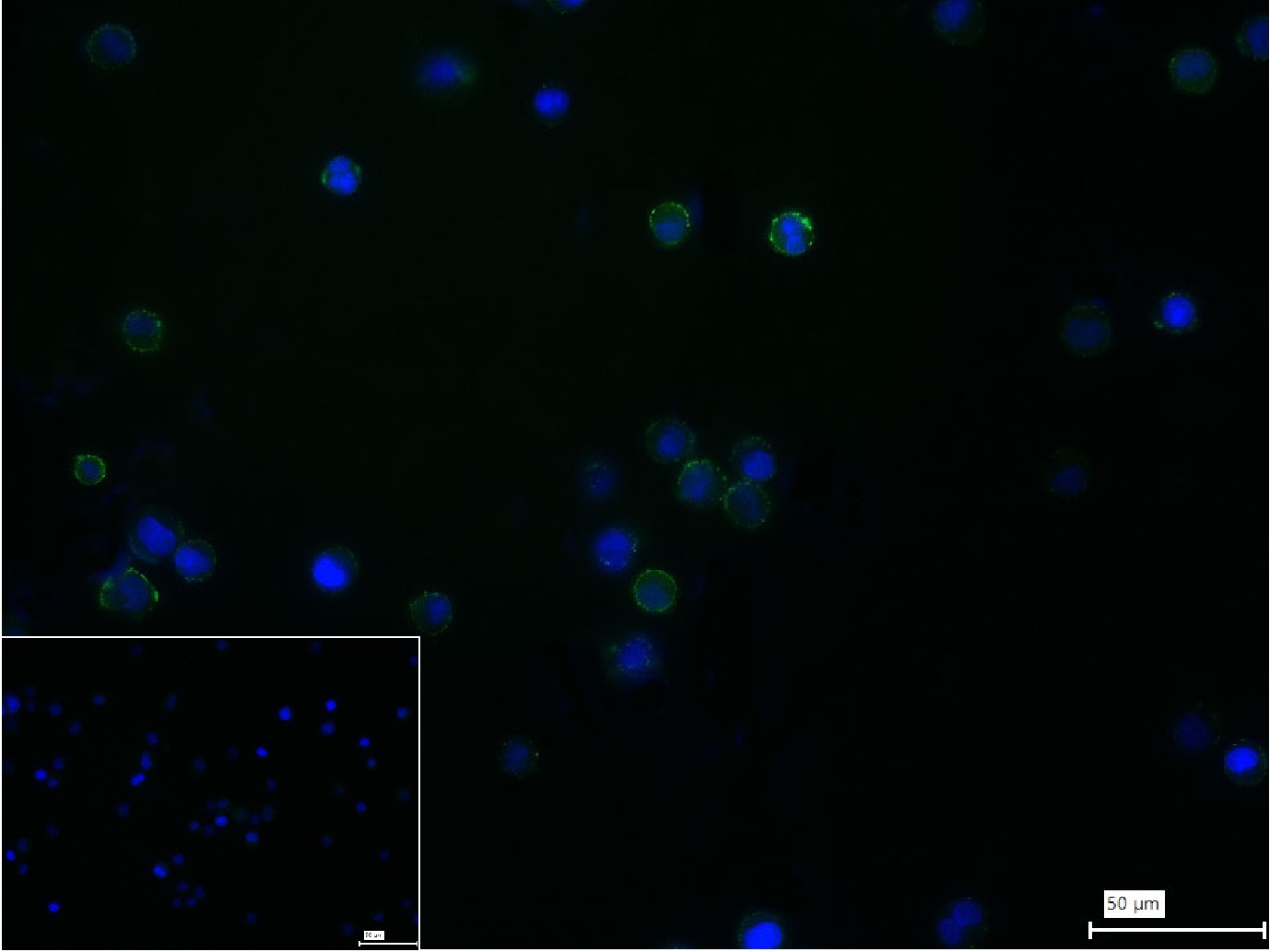 诱导协同刺激分子CD278重组兔单抗
