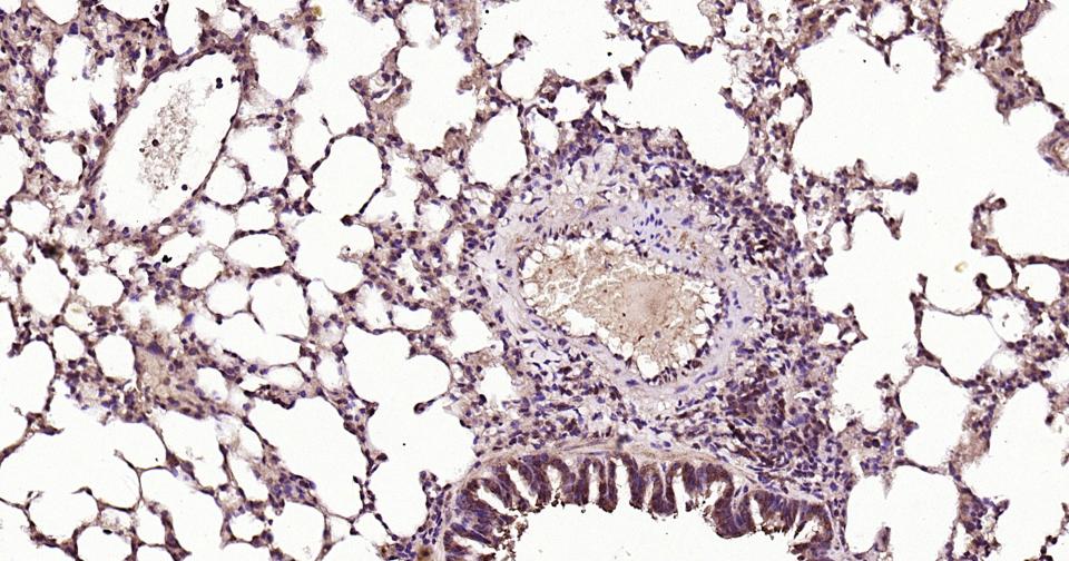 RAB5B Rabbit pAb (一抗) | Bioss