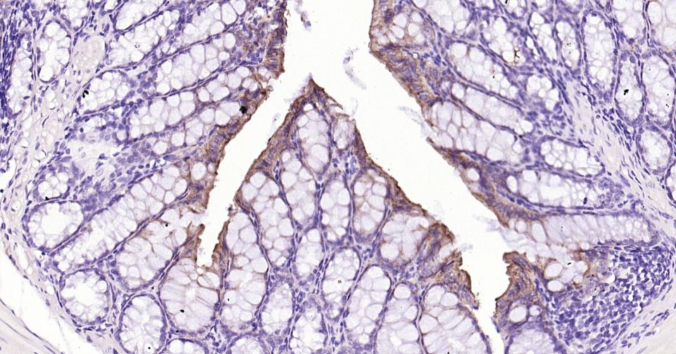 细胞色素cP450 CYP26A1重组兔单抗