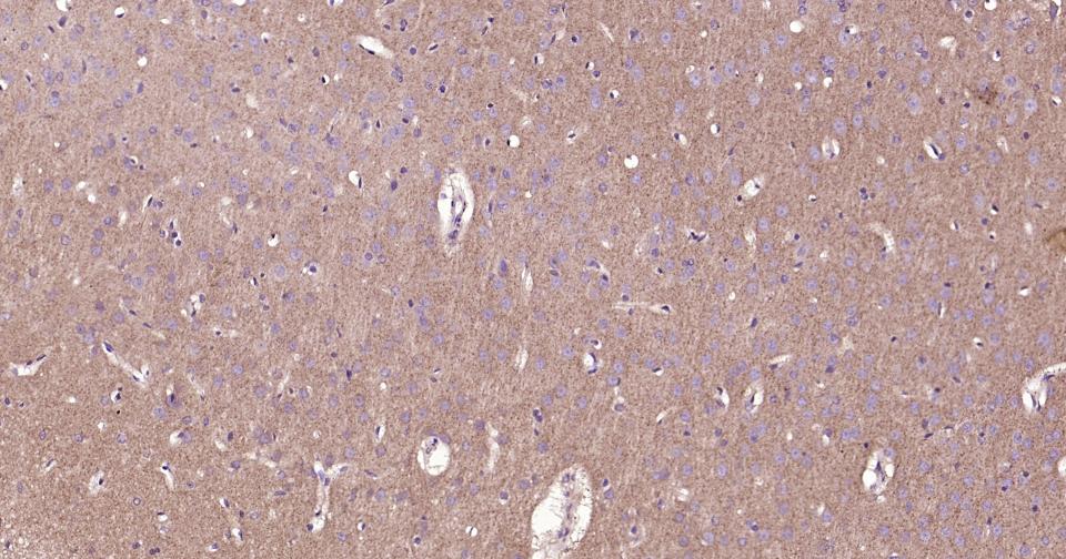 RAS相关蛋白Rab5B抗体-bs-11783R