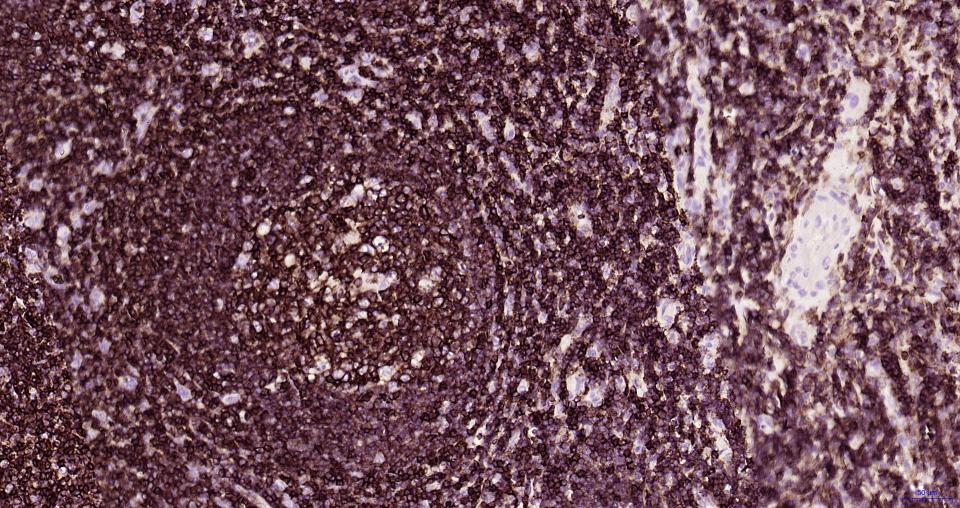 白细胞共同抗原CD45抗体-bs-0522R