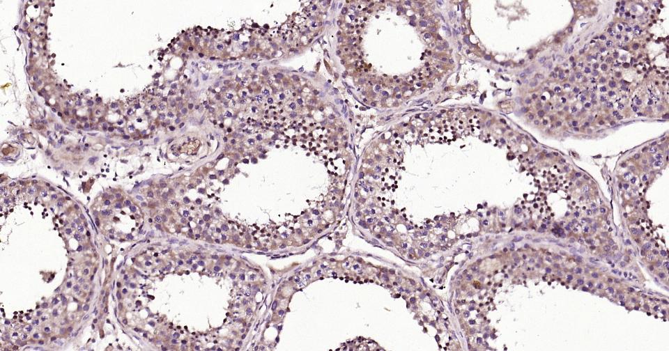 RAS相关蛋白Rab5B抗体-bs-11783R