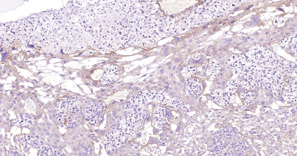 细胞色素cP450 CYP26A1重组兔单抗