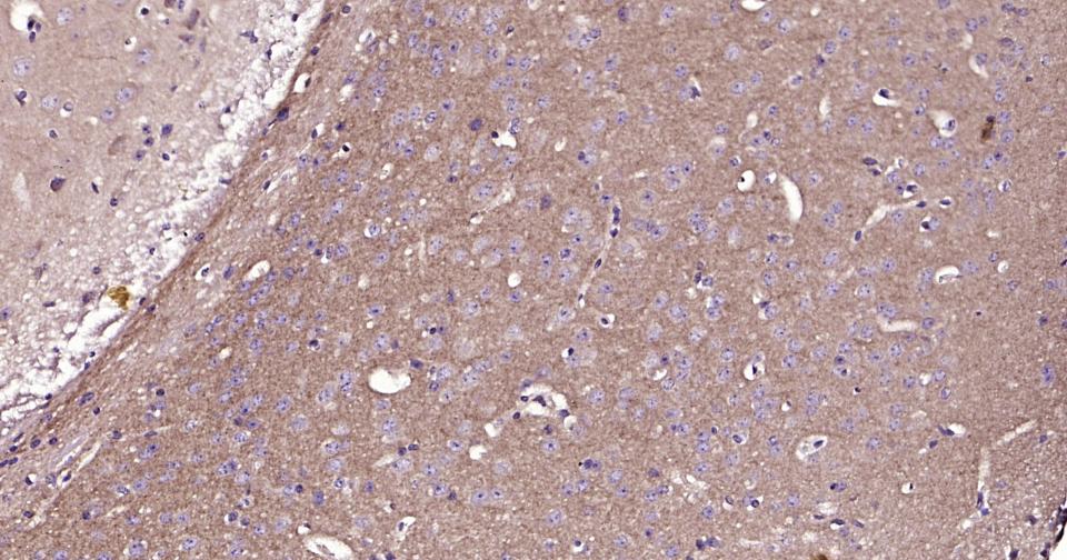 RAS相关蛋白Rab5B抗体-bs-11783R