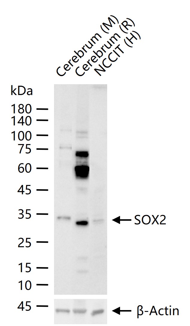 胚胎干细胞关键蛋白抗体-bs-23177R
