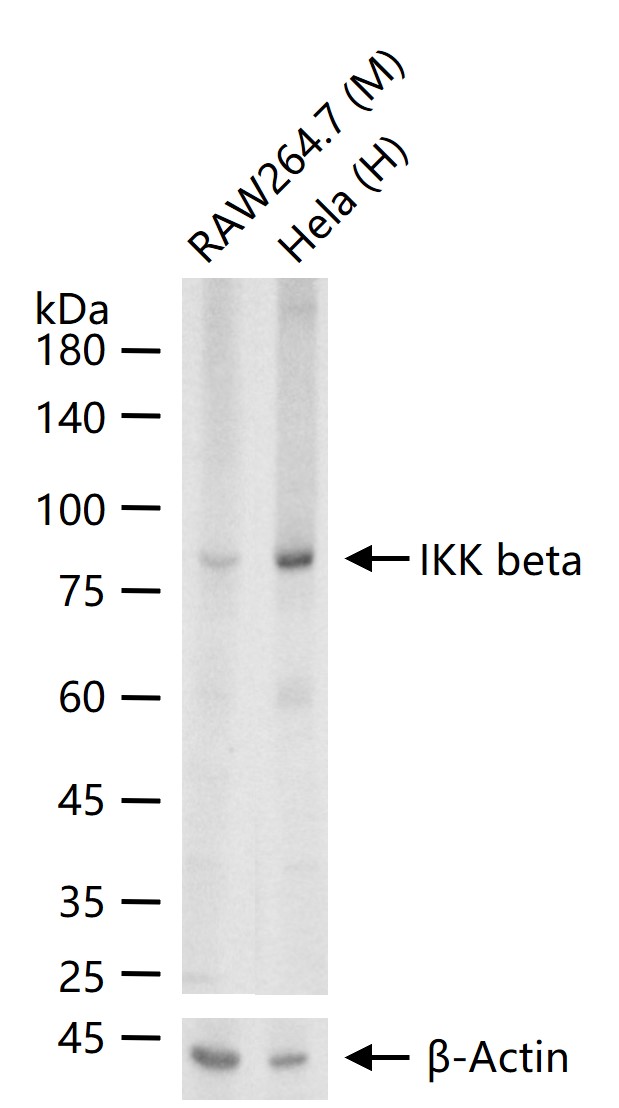 KB抑制蛋白激酶β重组兔单抗