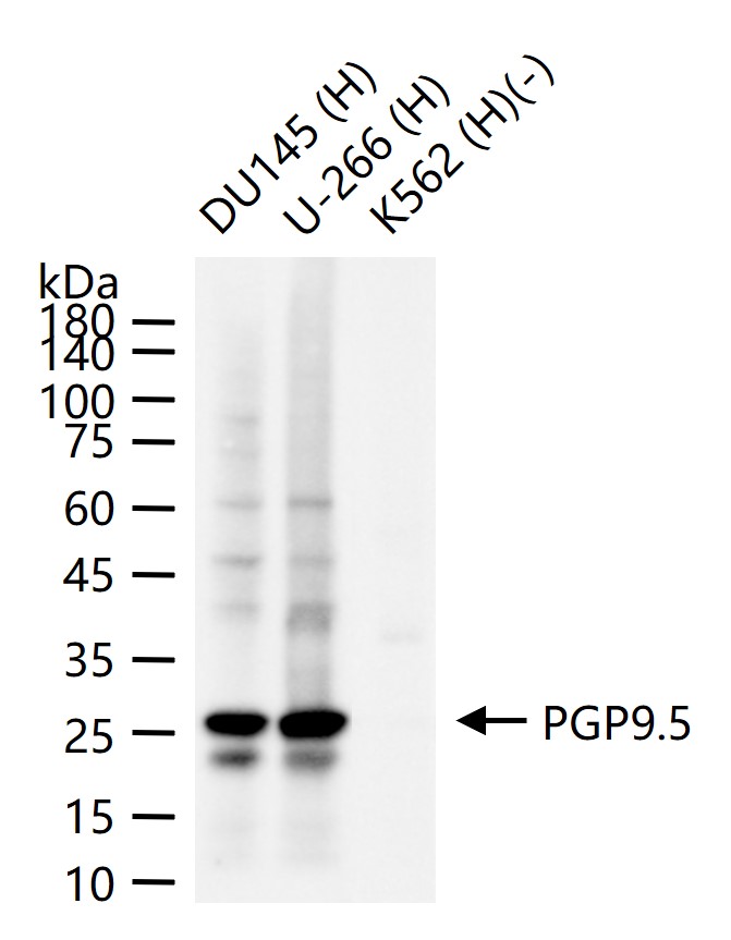 神经细胞胞浆蛋白9.5重组兔单抗