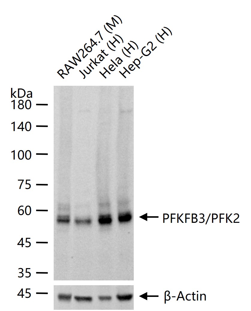 PFKFB3/PFK2 Recombinant Rabbit mAb (一抗) - WB,IHC-P,IHC-F,IF,Flow-Cyt,ICC/IF,IP | Bioss