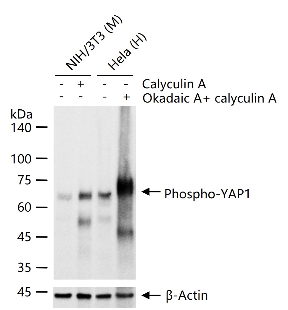 磷酸化原癌基因Yes相关蛋白1重组兔单抗