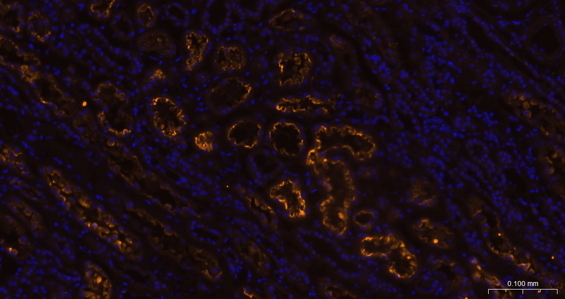 糖蛋白gp330重组兔单抗