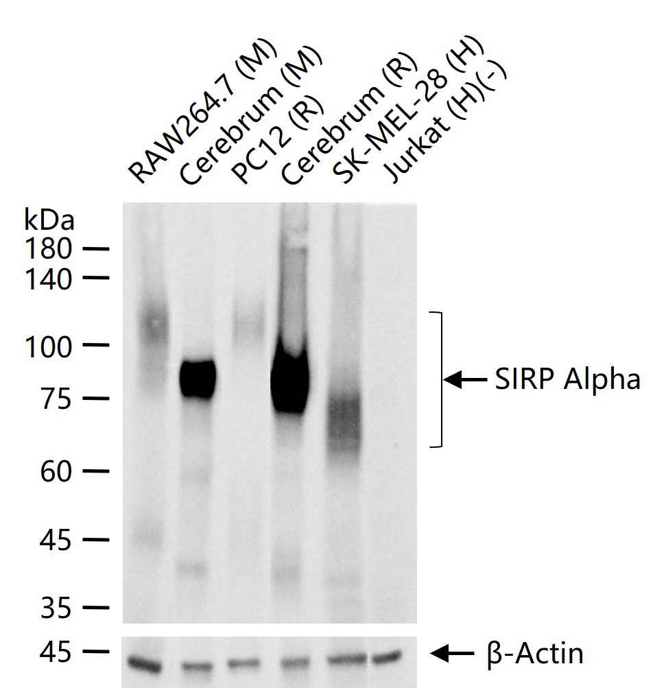 信号调节蛋白α重组兔单抗