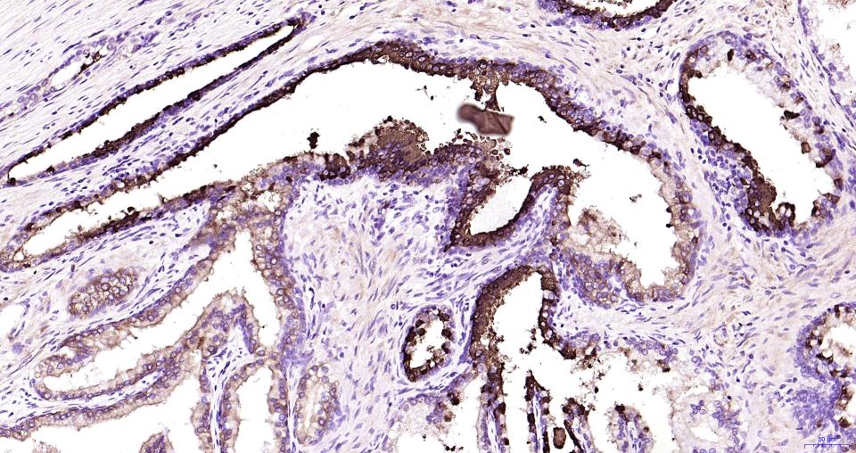 乳铁蛋白重组兔单抗